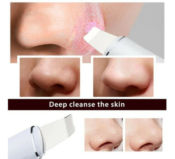 اتو صورت مدل التراسونیک شاول | leather shovel